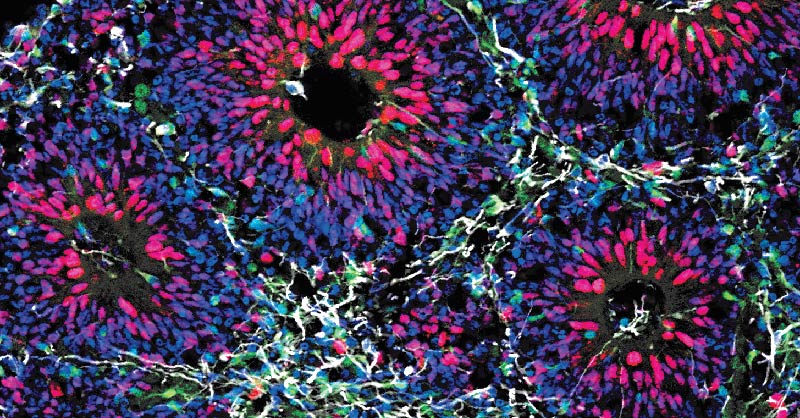 lab-grown brain organoids