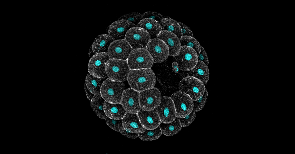 A sea star embryo imaged on a confocal microscope, showing cell membranes in gray and nuclei in cyan.