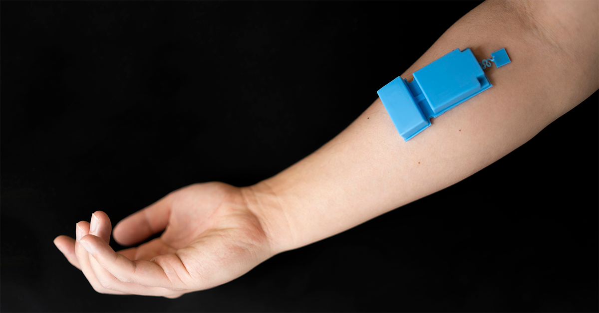 A small blue, rectangular box sits on a person's forearm.