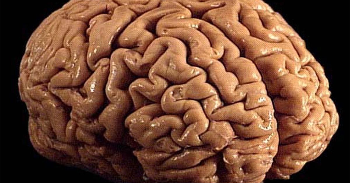 human brain