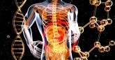 Reverse Metabolomics: New Method Finds Biomarker for Inflammatory Bowel Disease