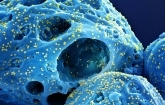 Why Subvariants of the SARS-CoV-2 Virus Accelerated the Pandemic