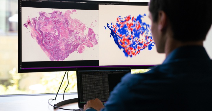 Profile image of male student looking at two computer screens showing tissue samples.