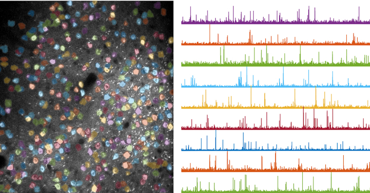 Neuroscientists Pinpoint Where (and How) Brain Circuits Are Reshaped as We Learn New Movements