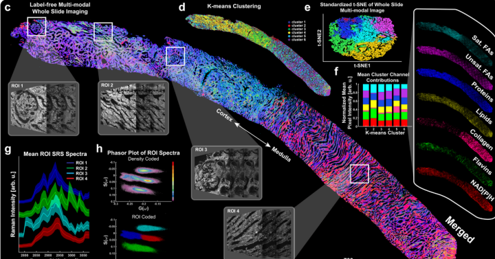 A whole slide image of a renal core biopsy from a patient diagnosed with Diabetic Nephropathy (DN) imaged using the platform described in the new paper in Nature Communications.