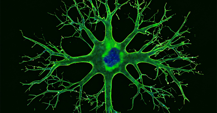 Aged neuron