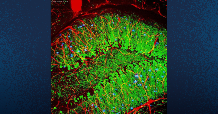 Scan of a mouse brain