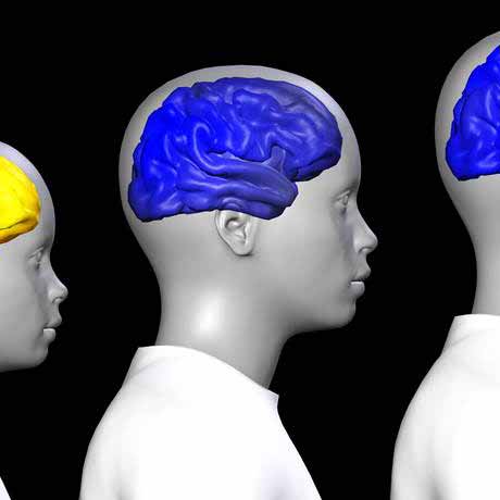 Uncovering the Secrets of the Adolescent Brain