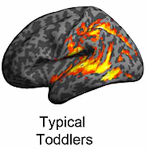 Brain Imaging Explains Reason for Good and Poor Language Outcomes in ASD Toddlers