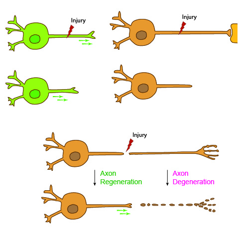 Discovery Offers New Genetic Pathway for Injured Nerve Regeneration