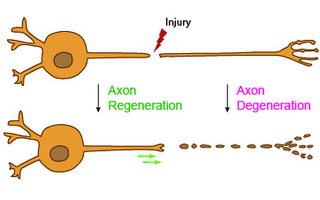 A cartoon depiction of axon injury and regeneration.