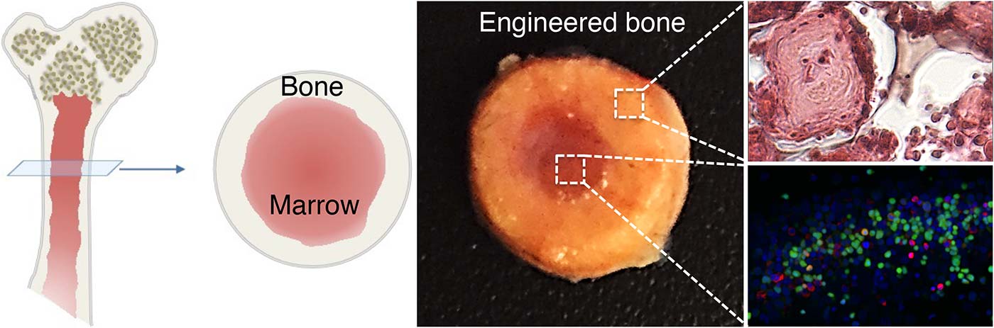 Engineered Bone Marrow Could Make Transplants Safer
