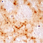 Small Loop in Human Prion Protein Prevents Chronic Wasting Disease