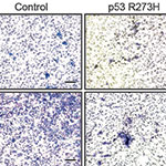 Mutant Gene Found to Fuel Cancer-Promoting Effects of Inflammation