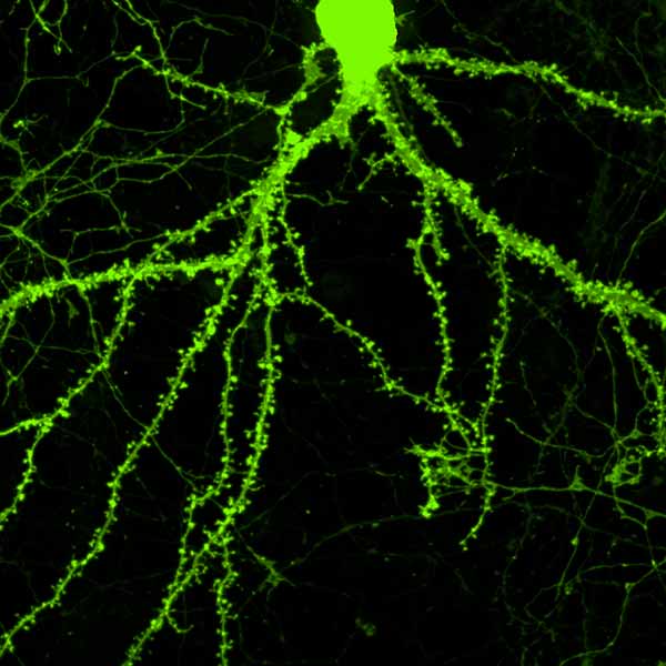 Neuronal Structures Associated with Learning and Memory Sprout In Response to Novel Molecules