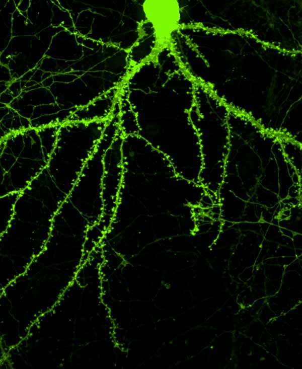 Image: Tiny thorns along the branches of this neuron are dendritic spines, which form the receiving end of synapses