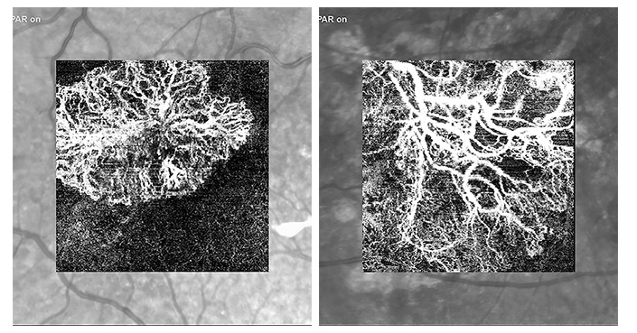 AIを利用してより良い視覚を実現する – 人間と機械の両方にとって(Using AI to Enable Better Vision – for Both Humans and Machines)