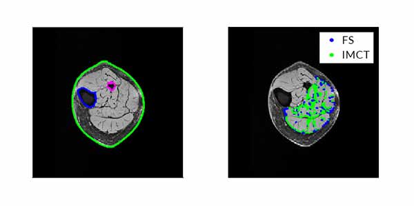 Outer contours and bone contours obtained from segmentation of MRI