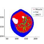 Engineers complete first comprehensive mesh-free numerical simulation of skeletal muscle tissue