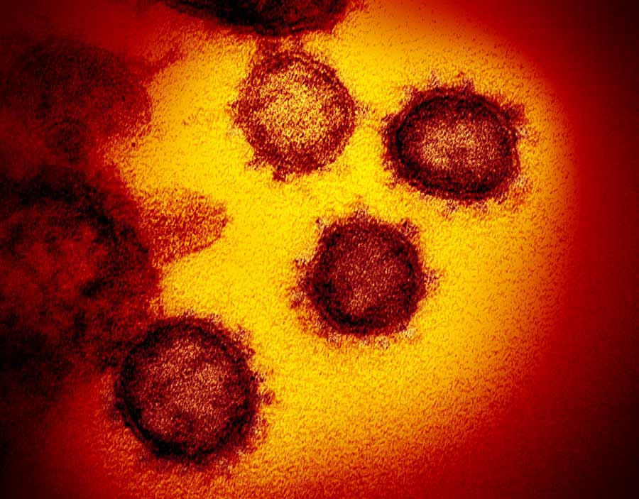 microscopic coronavirus