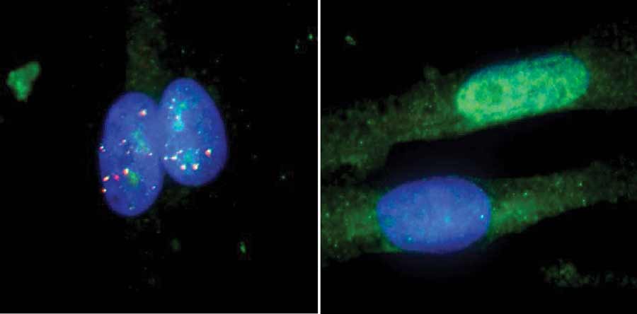 muscle cells on left untreated and muscle cells treated on right