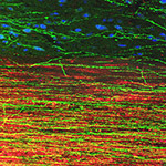 Dramatic Growth of Grafted Stem Cells in Rat Spinal Cord Injuries