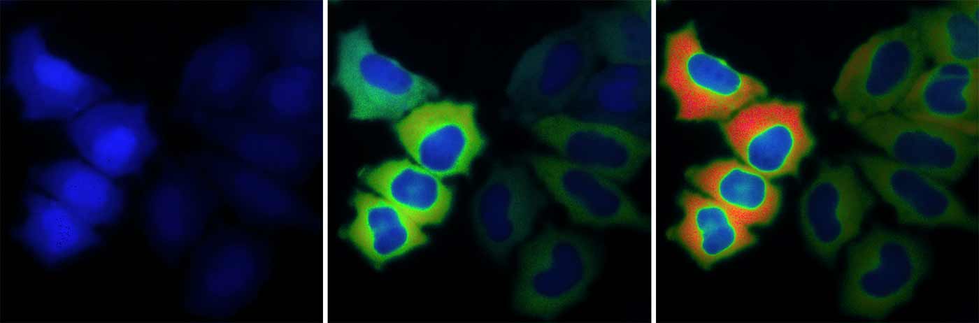 Ultrasensitive biosensors.