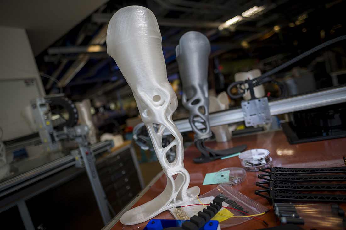 custom prosthesis.