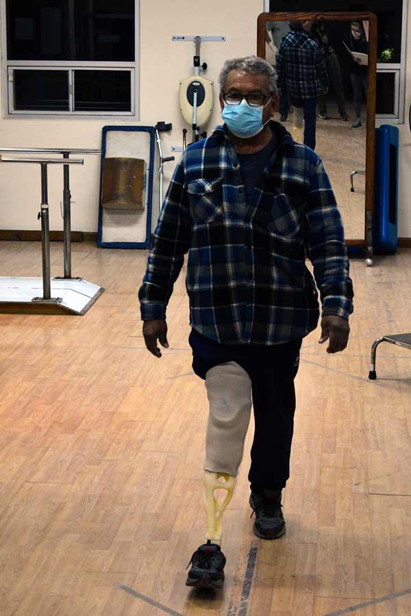 An amputee tests a LIMBER prosthesis at a clinic in Mexico.