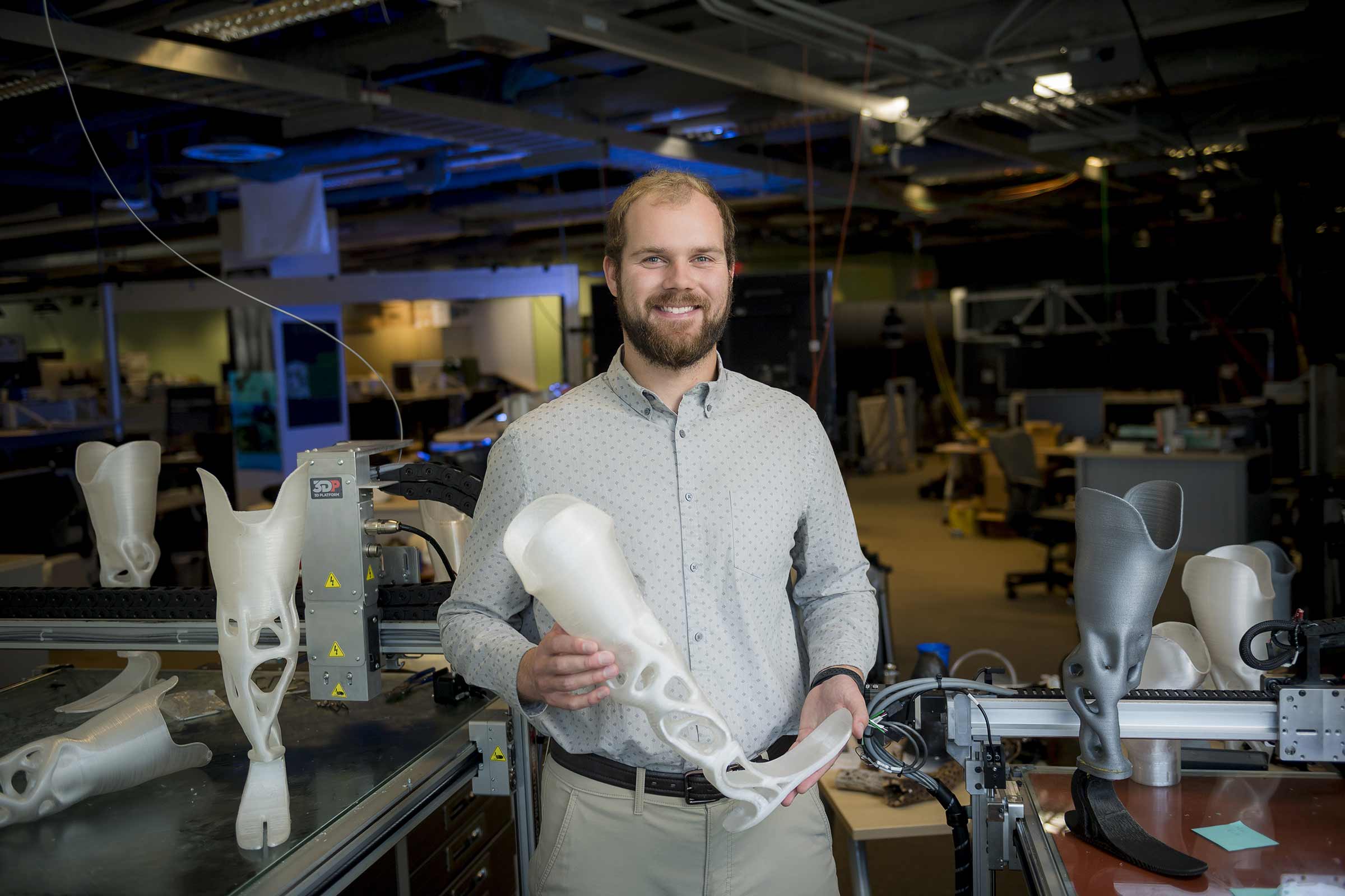 3d printed prosthetics