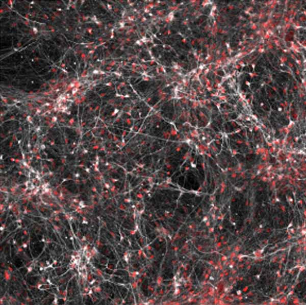 Image: Neurons (white/red) from a subset of bipolar patients show changes in their electrical activity in response to lithium.
