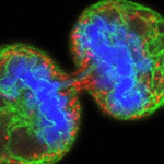 Split Decision: Stem Cell Signal Linked With Cancer Growth