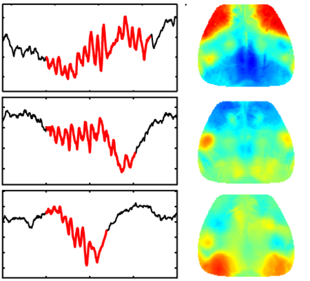 Transparent Brain Implant Can Read Deep Neural Activity From the Surface