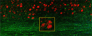 neuronal axons rodent