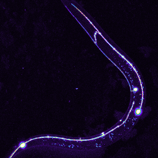 Biologists Uncover Details of How We Squelch Defective Neurons