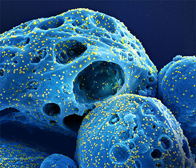 SARS-CoV-2ウイルスの亜種がパンデミックを加速させた理由(Why Subvariants of the SARS-CoV-2 Virus Accelerated the Pandemic)