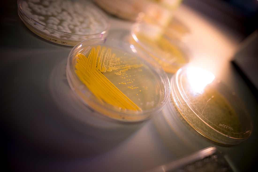 Petri dishes.