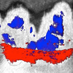 New Dental Imaging Method Uses Squid Ink to Fish for Gum Disease