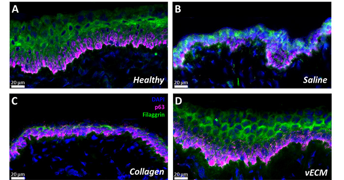 Photos showing vaginal tissue with different treatments