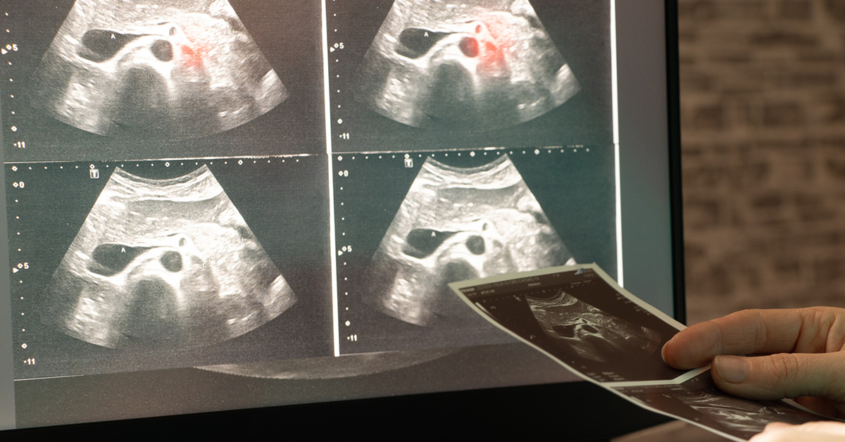 New AI Tool Learns to Read Medical Images With Far Less Data – San ...