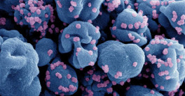 A graphic image of a cell infected with SARS-CoV-2 virus particles