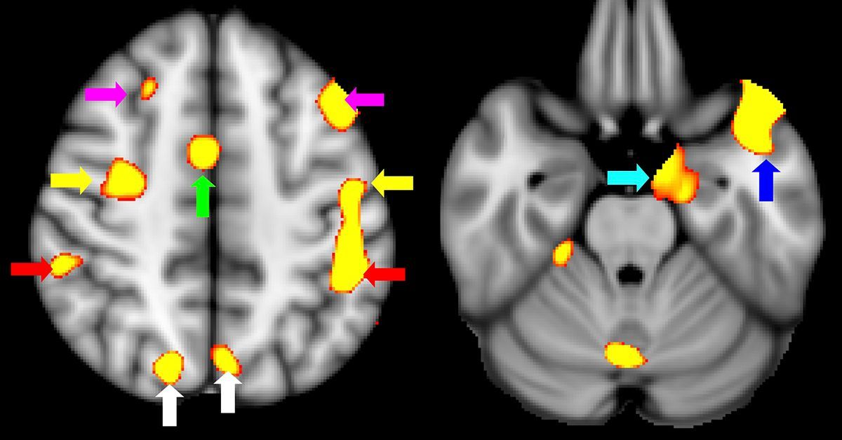 Researchers Show Visual Training Dramatically Improves Cognitive Function After Concussion
