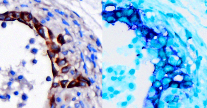 pancreas cells